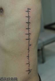 fomba fanao mifanila amin'ny lafiny kiraro ECG tatoazy