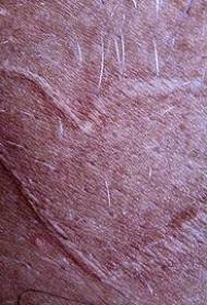 heart-shaped tattoo pattern of leg skin scratches